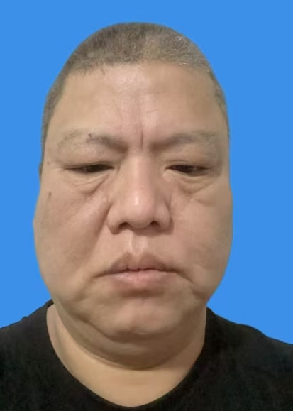 林丕何